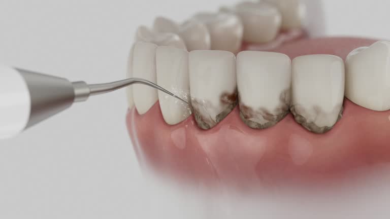 Reliable Dental Implants contractor in Torrington, WY by Smile Center Dentistry